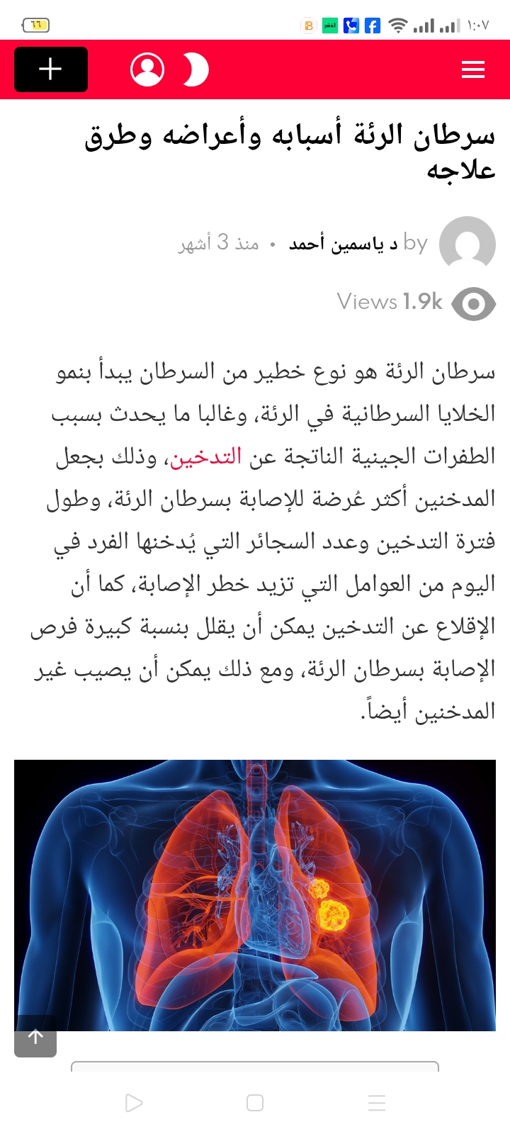 سرطان الرئة